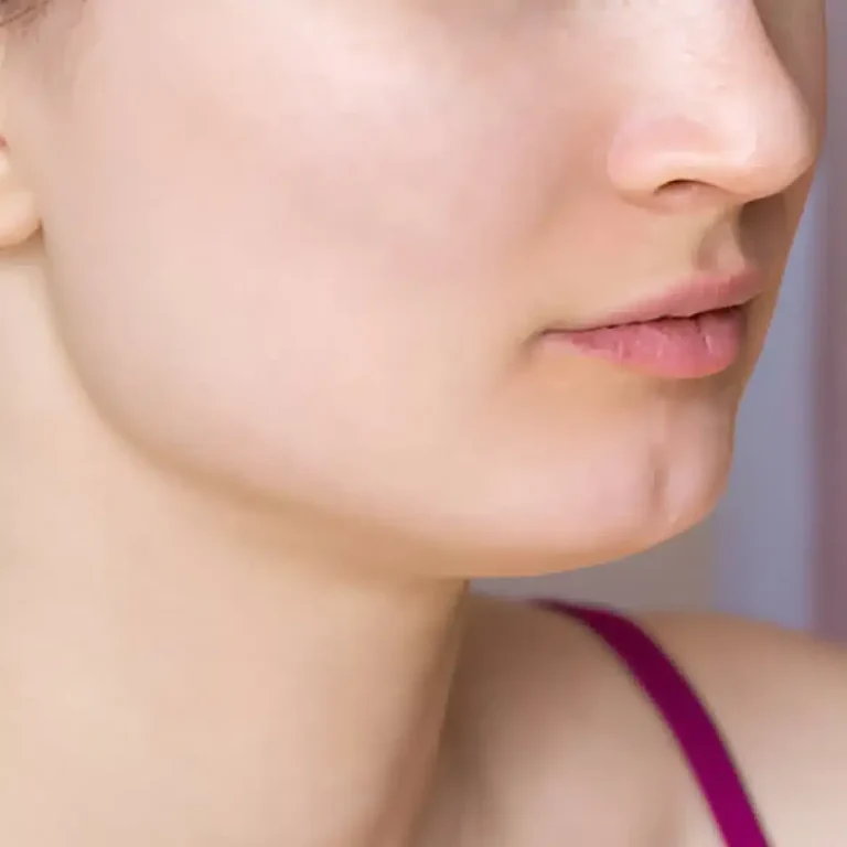 Explore Safe Options for Vitiligo and Scar Care in Dubai