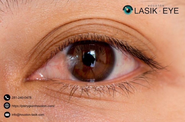 Practical guide to eye surgery outcomes and pterygium care