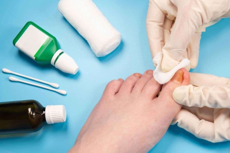 Relief for Bunions: Practical Strategies from UK-Qualified Experts Relief for Bunions: Practical Strategies from UK-Qualified Experts