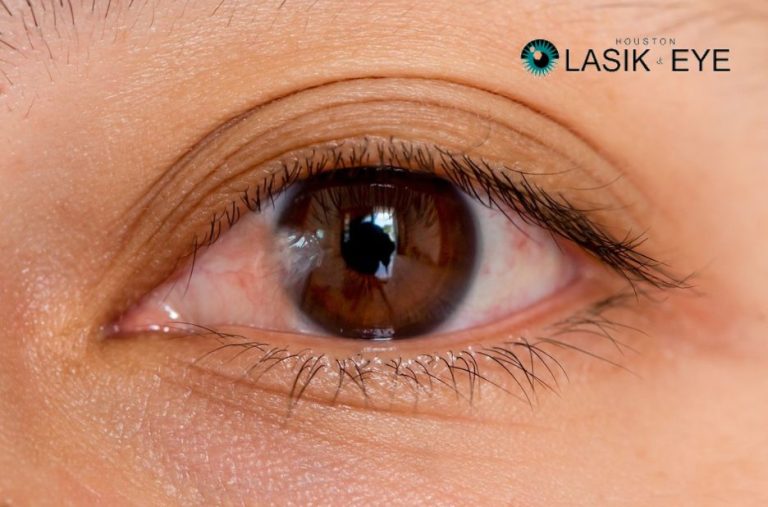 Practical Guide to Removing Pterygium and Aftercare