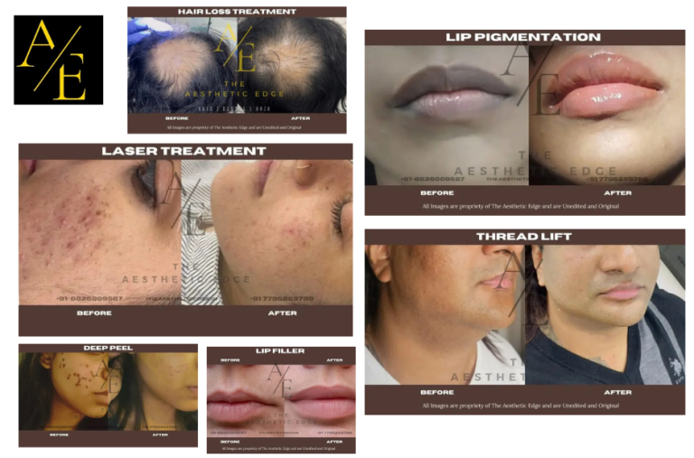 Top Aesthetic Clinic Bangalore for Expert Skin, Hair, and Laser Treatments