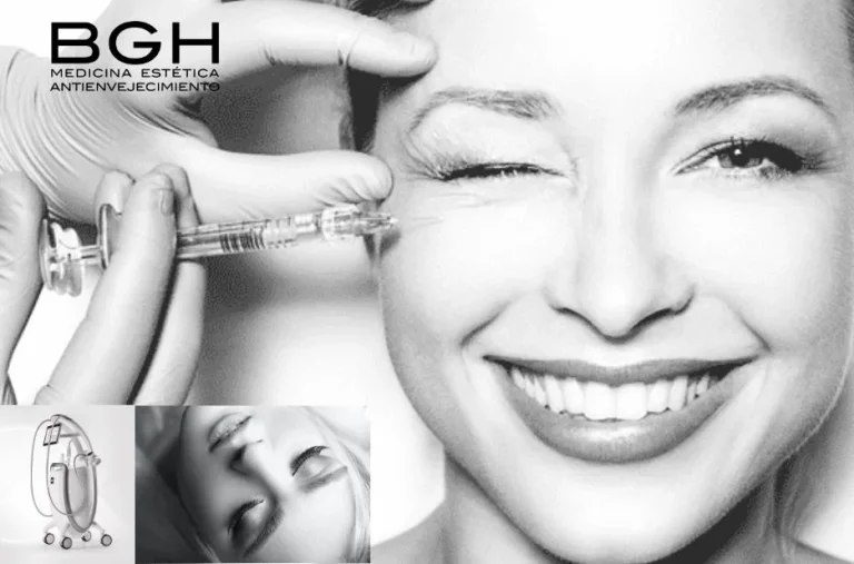 Acné facial soluciones efectivas para una piel limpia y saludable