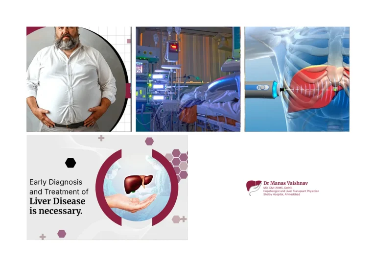 Top Liver Specialist Doctor in Ahmedabad for Advanced Hepatology Care and Treatment