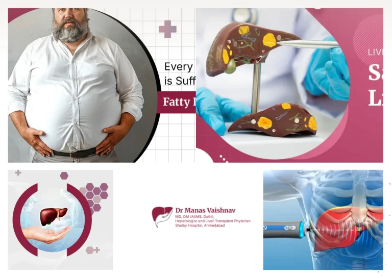 Best Gastroenterologist Ahmedabad for Expert Liver and GI Care